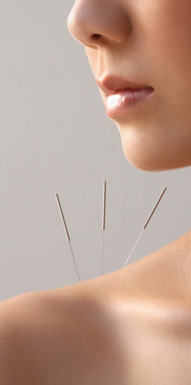 ACUPUNCTURE, THE POINT OF WELL-BEING