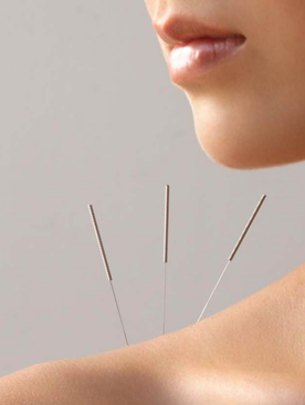 ACUPUNCTURE, THE POINT OF WELL-BEING